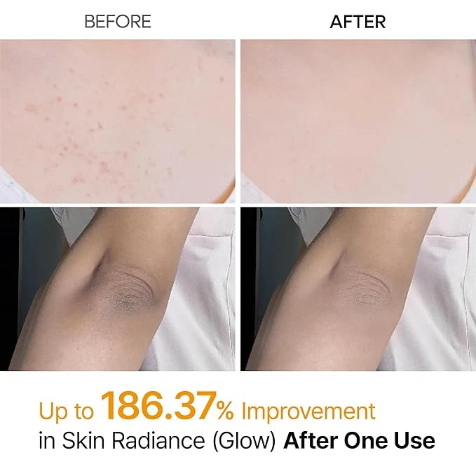 Dr.Melaxin - Peel Shot Advance Kojic Acid Spray